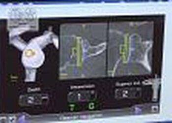 Dopo Siena, il secondo interento a Venezia di protesi utilizzando un “navigatore” Gps