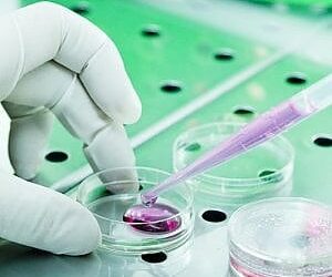 Ricerca: in prova un nuovo farmaco blocca ‘travestimento’ cellule malate