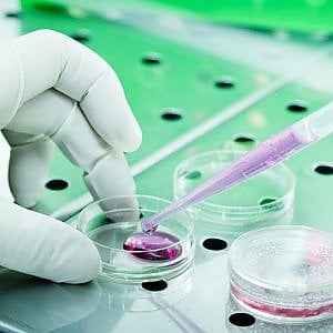 Ricerca: in prova un nuovo farmaco blocca ‘travestimento’ cellule malate