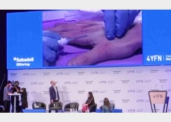 Al Mwc volontario si fa impiantare chip