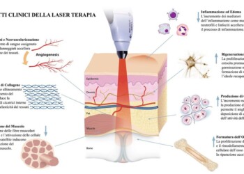GLI EFFETTI TERAPEUTICI DEL LASER
