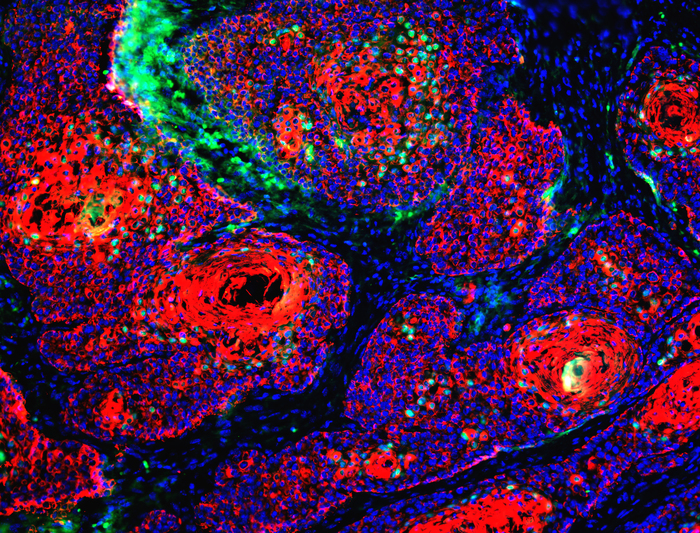 Nessuna ‘sfortuna’, a causare i tumori sono fattori esterni