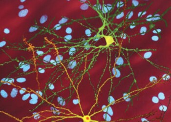 Nuove ‘brecce’ per attaccare la malattia di Huntington