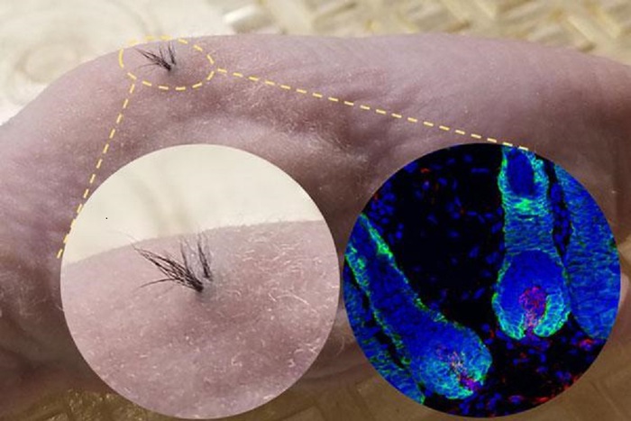 Coltivati in laboratorio i primi capelli con il ‘tutor’