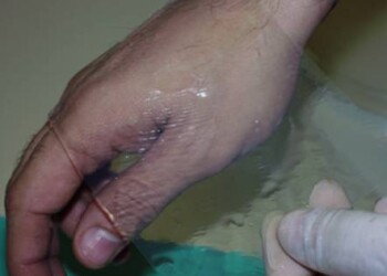 Dai cammelli alle meduse, l’arca di Noè dei biomateriali