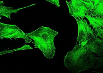 E’ una proteina a nutrire i tumori. Scoperta tutta italiana