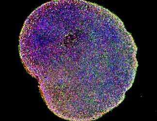 Mini-cervelli prodotti in serie