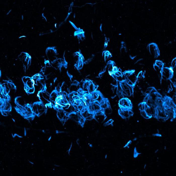 Scoperta la proteina che ripara il Dna delle cellule nervose