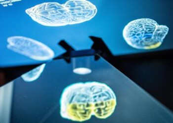 Innovazione: copiare il cervello, è la ‘brain inspired computation’
 