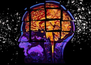 L’intelligenza artificiale prevede la progressione dell’Alzheimer