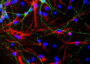 Ringiovanite le cellule progenitrici del cervello