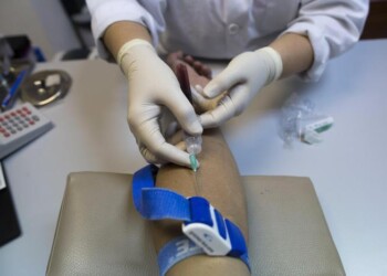 Nasconde Hiv e contagia donne, una muore