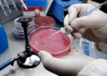 Superbatterio, 17 morti sospette