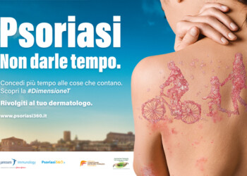 “DIMENSIONE T. PSORIASI NON DARLE TEMPO” LA NUOVA DIMENSIONE NELL’APPROCCIO ALLA PSORIASI