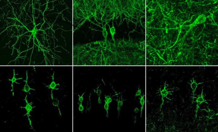 Fotografati i neuroni al lavoro