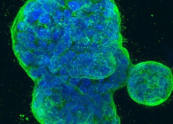 Fermato il ‘basista’ che aiuta le metastasi