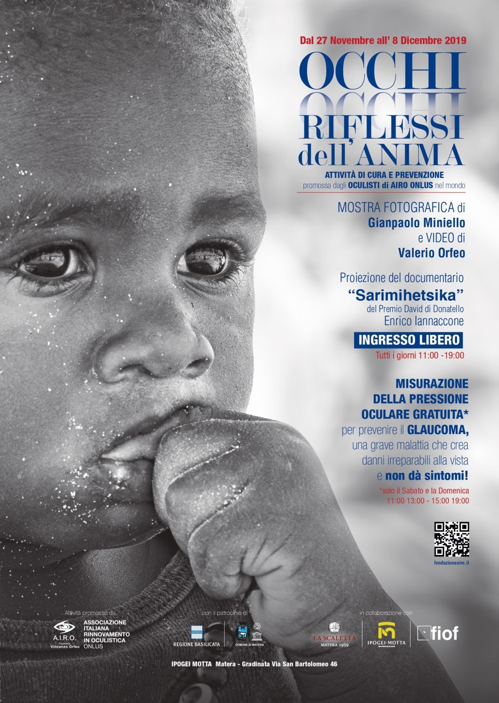 Matera: Prevenzione glaucoma, nel weekend misurazione gratuita della pressione oculare