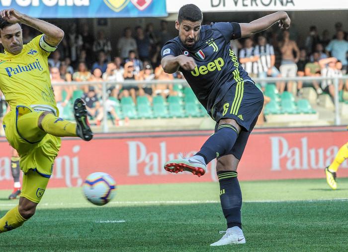 Khedira operato, tre mesi di stop per il centrocampista