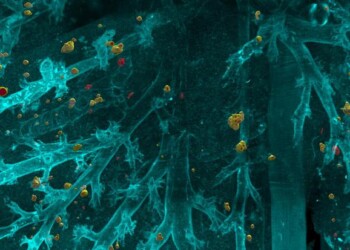 L’intelligenza artificiale scova le metastasi invisibili VIDEO