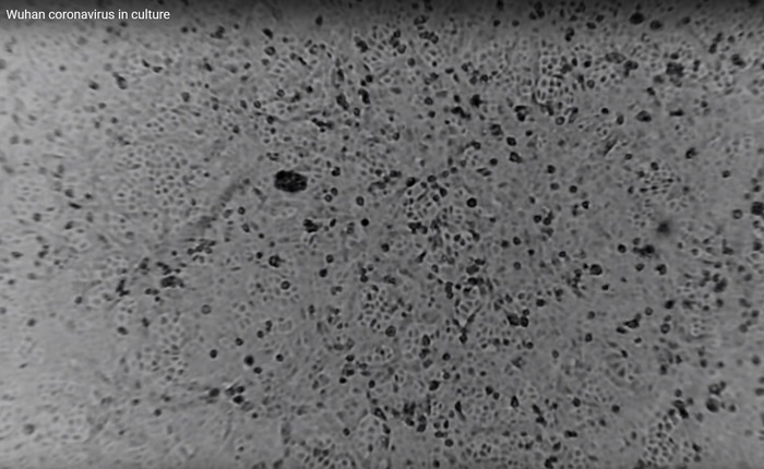 Coronavirus 2019-nCoV coltivato in un laboratorio fuori dalla Cina – VIDEO