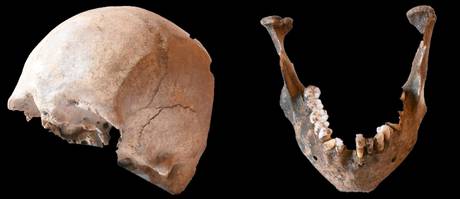 Cranio misterioso potrebbe essere di Plinio il Vecchio