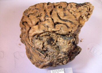 Il segreto del frammento di cervello intatto da 2.600 anni
