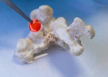 Ambiente: arriva il cerotto intelligente che cura i coralli 