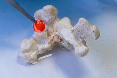 Coralli malati, si cureranno con un cerotto (VIDEO)