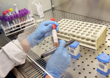 Coronavirus, accertamenti su termolese