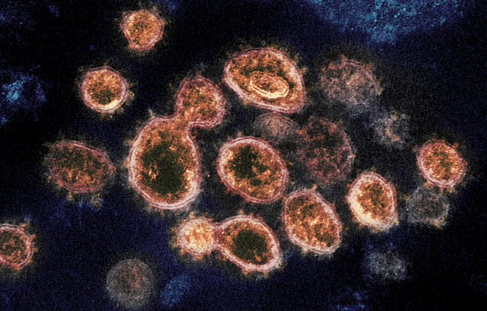 Coronavirus, cambia lo scenario dell’epidemia in Italia