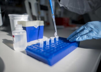 Coronavirus, in E-R 115 casi, 6 più seri