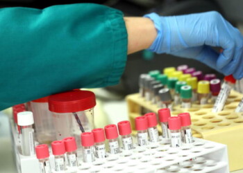 Coronavirus, negativo test per termolese