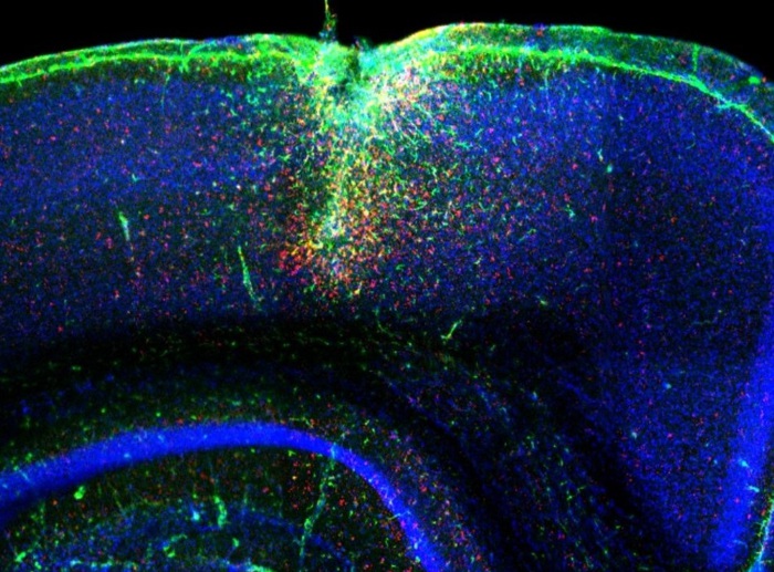 La molecola che attiva i neuroni con la luce