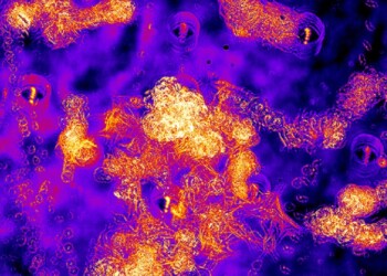 La più grande banca dati dei tumori avvicina le cure su misura