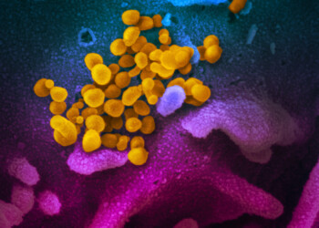 Coronavirus, scoperta una nuova via con cui invade le cellule