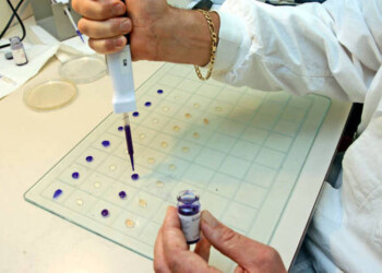 Coronavirus:oggi 88 positivi, totale 837