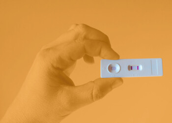 Il Test Nib pre biopsia prostatica: affidabile, a basso costo e rapido