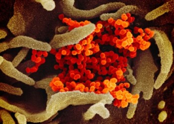 Coronavirus: cellule bersaglio in naso, polmoni e intestino