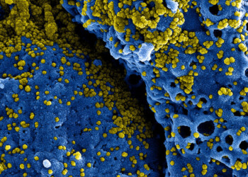 Coronavirus, ottenuti due farmaci su misura