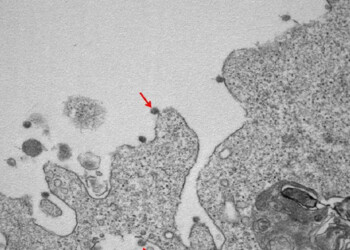 Coronavirus: prime foto del virus isolato in Lombardia