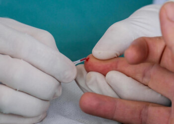 Covid: Toscana, test sangue per 400.000