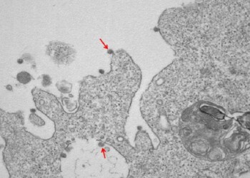 Fotografato il virus in circolazione in Italia