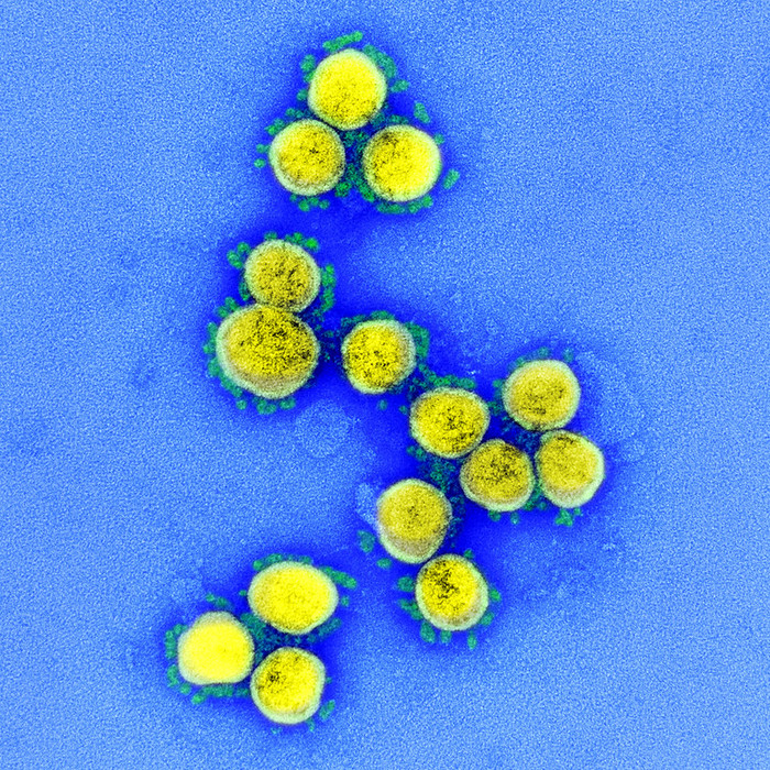 Il coronavirus può resistere nell’aria fino a 16 ore