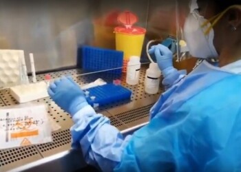 Test sierologici privati, arriva lo stop