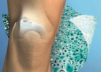 Cerotti ultrasottili per rigenerare i tessuti