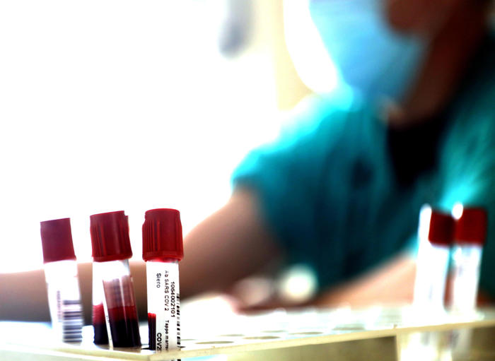 Coronavirus: 7 decessi in Puglia e 5 nuovi contagi