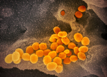 Coronavirus, funzionano gli anticorpi del vaccino italiano