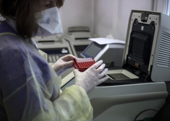 Coronavirus: Fvg, 3.156 positivi (+8), 316 decessi (+3)