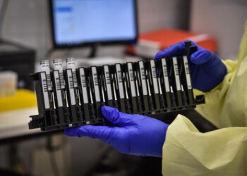 Coronavirus: in E-R 45 nuovi casi e 8 morti da ieri