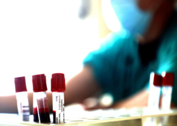 Coronavirus: Ordine Medici, no ai test seriologici per tutti